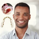 Caring for Your Smile After the Braces Come Off