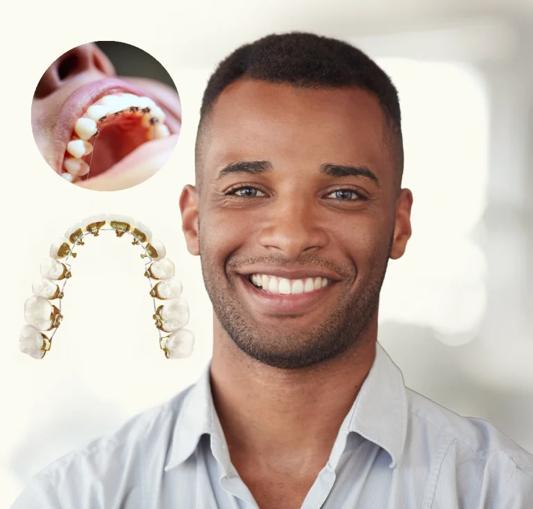 Caring for Your Smile After the Braces Come Off